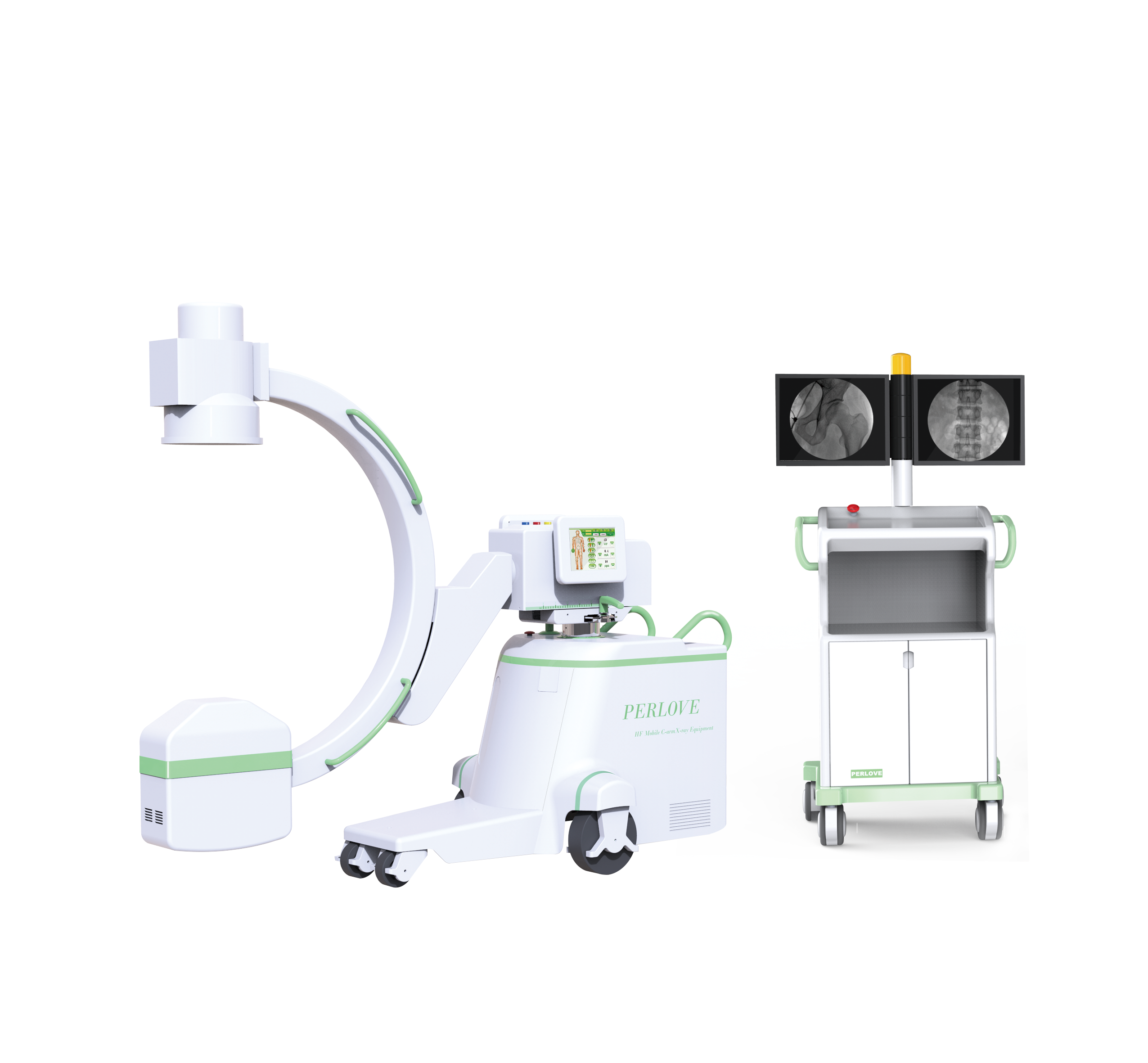 China High Frequency Mobile C-arm System